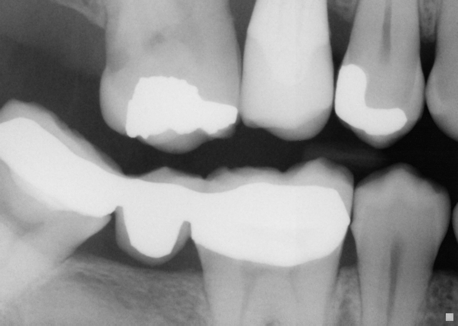 Digital Radiography and modern Dentistry at Jefferson Dental Center in South Bend